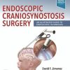 Endoscopic Craniosynostosis Surgery: An Illustrated Guide to Endoscopic Techniques (PDF)