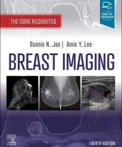 Breast Imaging: The Core Requisites, 4th edition (PDF)