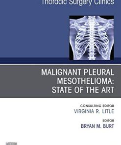 Malignant Pleural Mesothelioma, An Issue of Thoracic Surgery Clinics (Volume 30-4) (The Clinics: Surgery, Volume 30-4) (PDF)