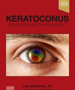 Keratoconus: Diagnosis and Management (PDF)