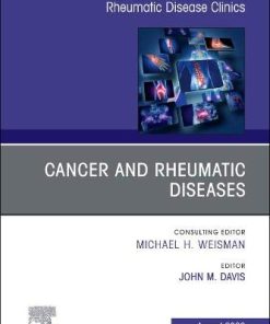 Cancer and Rheumatic Diseases, An Issue of Rheumatic Disease Clinics of North America (Volume 46-3) (The Clinics: Internal Medicine, Volume 46-3) (PDF)