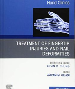 Treatment of fingertip injuries and nail deformities, An Issue of Hand Clinics (Volume 37-1) (The Clinics: Orthopedics, Volume 37-1) (PDF)