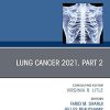 Lung Cancer 2021, Part 2, An Issue of Thoracic Surgery Clinics (Volume 31-4) (The Clinics: Surgery, Volume 31-4) (PDF)