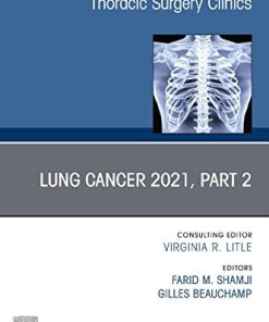 Lung Cancer 2021, Part 2, An Issue of Thoracic Surgery Clinics (Volume 31-4) (The Clinics: Surgery, Volume 31-4) (PDF)