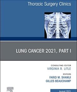 Lung Cancer 2021, Part 1, An Issue of Thoracic Surgery Clinics (Volume 31-3) (The Clinics: Surgery, Volume 31-3) (PDF)