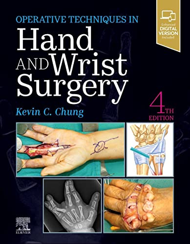 Operative Techniques: Hand and Wrist Surgery, 4th Edition (PDF) Operative Techniques: Hand and Wrist Surgery, 4th Edition (PDF)