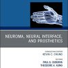 Neuroma, Neural interface, and Prosthetics, An Issue of Hand Clinics (Volume 37-3) (The Clinics: Orthopedics, Volume 37-3) (PDF)