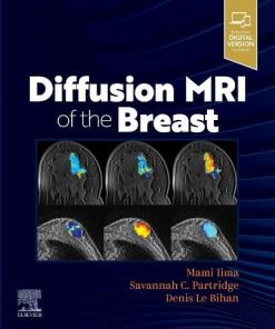 Diffusion MRI of the Breast (PDF)