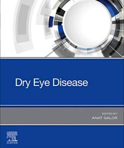 Dry Eye Disease (PDF)