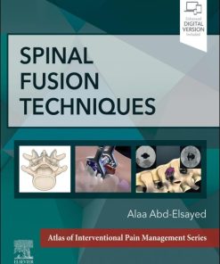 Spinal Fusion Techniques (EPUB)