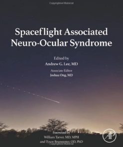 Spaceflight Associated Neuro-Ocular Syndrome (PDF)