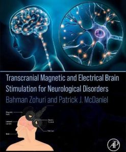 Transcranial Magnetic and Electrical Brain Stimulation for Neurological Disorders (PDF)