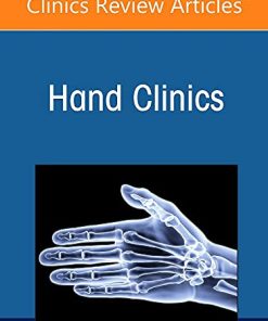 Current Concepts in Thumb Carpometacarpal Joint Disorders, An Issue of Hand Clinics (Volume 38-2) (The Clinics: Internal Medicine, Volume 38-2) (PDF)