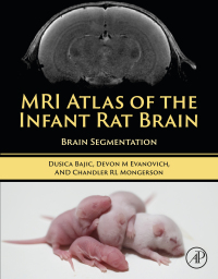 MRI Atlas of the Infant Rat Brain: Brain Segmentation (EPUB)