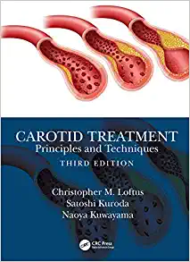 Carotid Treatment: Principles and Techniques, 3rd Edition (PDF)