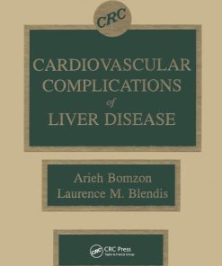 Cardiovascular Complications of Liver Disease (EPUB)