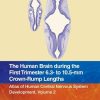 The Human Brain during the First Trimester 6.3- to 10.5-mm Crown-Rump Lengths: Atlas of Human Central Nervous System Development, Volume 2 (Atlas of Human Central Nervous System Development, 2) (PDF)