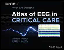 Hirsch and Brenner’s Atlas of EEG in Critical Care, 2nd Edition (PDF)