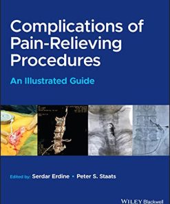 Complications of Pain-Relieving Procedures: An Illustrated Guide (EPUB)