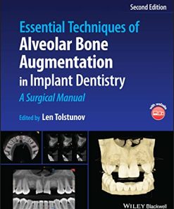 Essential Techniques of Alveolar Bone Augmentation in Implant Dentistry: A Surgical Manual, 2nd Edition (PDF)