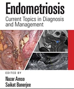 Endometriosis: Current Topics in Diagnosis and Management (EPUB)