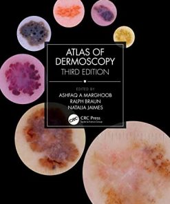 Atlas of Dermoscopy: Third Edition (EPUB)