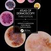 Atlas of Dermoscopy: Third Edition (PDF)