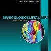 Musculoskeletal MRI, 2nd Edition (PDF)