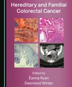 Hereditary and Familial Colorectal Cancer (PDF)