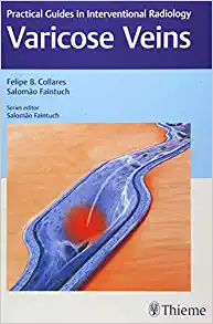 Varicose Veins: Practical Guides in Interventional Radiology (EPUB)