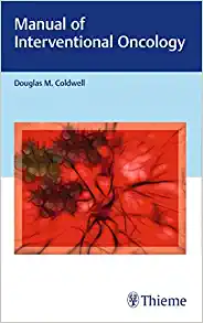 Manual of Interventional Oncology, 1st edition (EPUB)