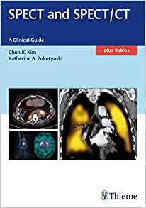 SPECT and SPECT/CT: A Clinical Guide (EPUB)