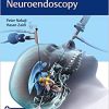 Controversies in Neuroendoscopy (EPUB)