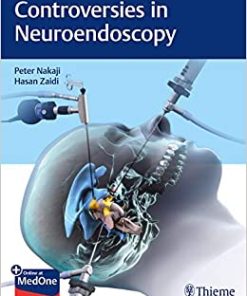 Controversies in Neuroendoscopy (EPUB)