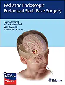 Pediatric Endoscopic Endonasal Skull Base Surgery (EPUB)