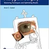 The Art of Pterygium Surgery: Mastering Techniques and Optimizing Results (EPUB)