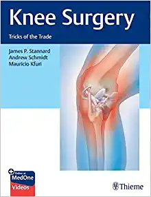 Knee Surgery: Tricks of the Trade (EPUB)