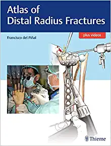 Atlas of Distal Radius Fractures (EPUB)