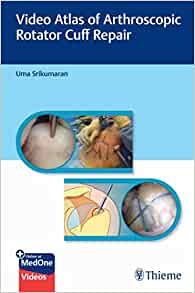 Video Atlas of Arthroscopic Rotator Cuff Repair (EPUB)