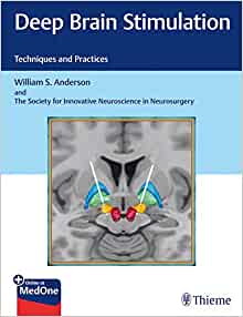 Deep Brain Stimulation: Techniques and Practices (EPUB)