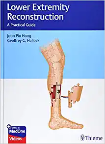 Lower Extremity Reconstruction: A Practical Guide (EPUB)