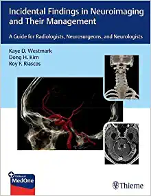 Incidental Findings in Neuroimaging and Their Management: A Guide for Radiologists, Neurosurgeons, and Neurologists (EPUB)