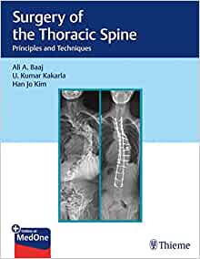 Surgery of the Thoracic Spine: Principles and Techniques (EPUB)