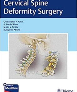 Cervical Spine Deformity Surgery (EPUB)