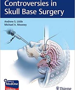 Controversies in Skull Base Surgery (EPUB)