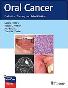 Oral Cancer: Evaluation, Therapy, and Rehabilitation (EPUB)