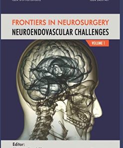 NeuroEndovascular Challenges: Frontiers in Neurosurgery Volume 1 (PDF)