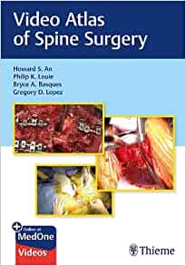 Video Atlas of Spine Surgery (EPUB)