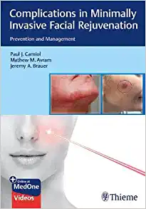 Complications in Minimally Invasive Facial Rejuvenation: Prevention and Management (EPUB)