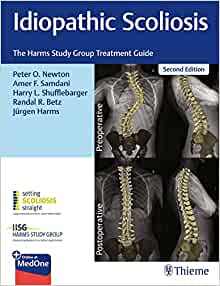 Idiopathic Scoliosis: The Harms Study Group Treatment Guide, 2nd Edition (EPUB)